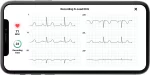 KardiaMobile 6L Personal EKG Monitor with Most Smartphones - Image 5